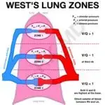 https://rk.md/2021/wests-lung-zones/