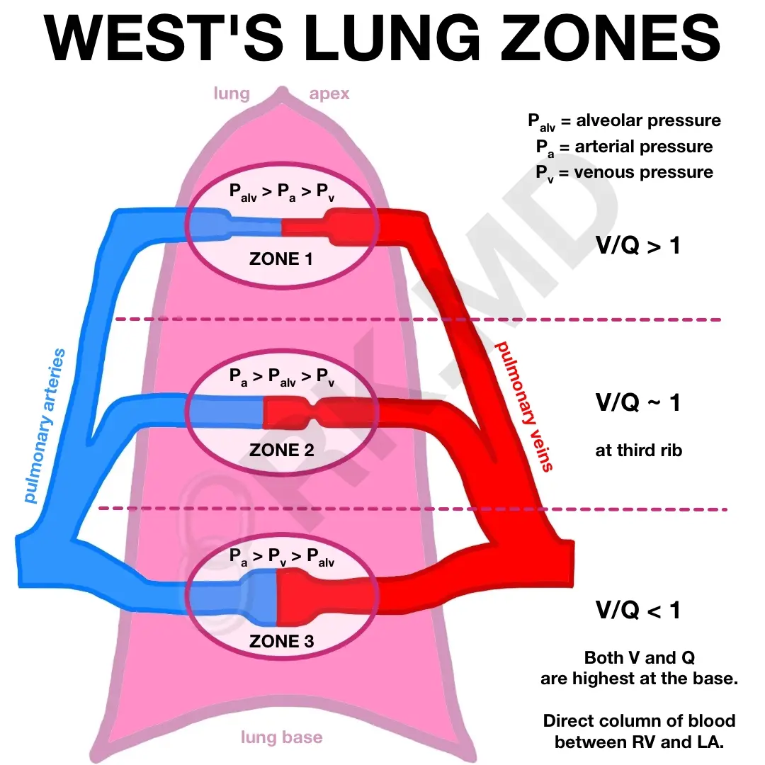 https://rk.md/2021/wests-lung-zones/